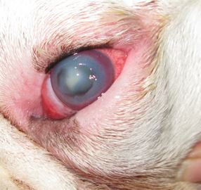 Advanced keratomalacia of the left eye